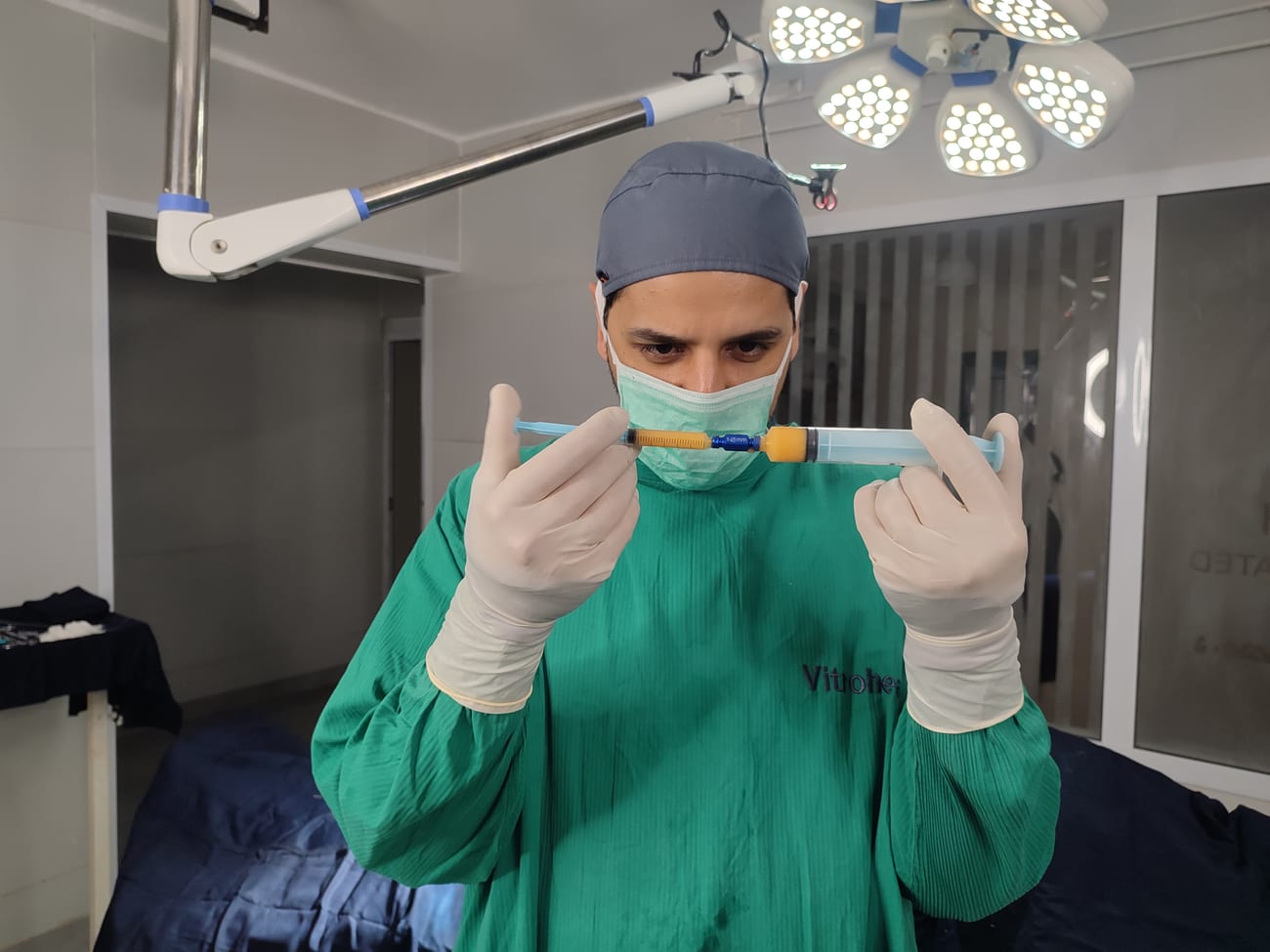 Purified pure golden fat prepared for nanofat injection — no blood or tumescent fluid