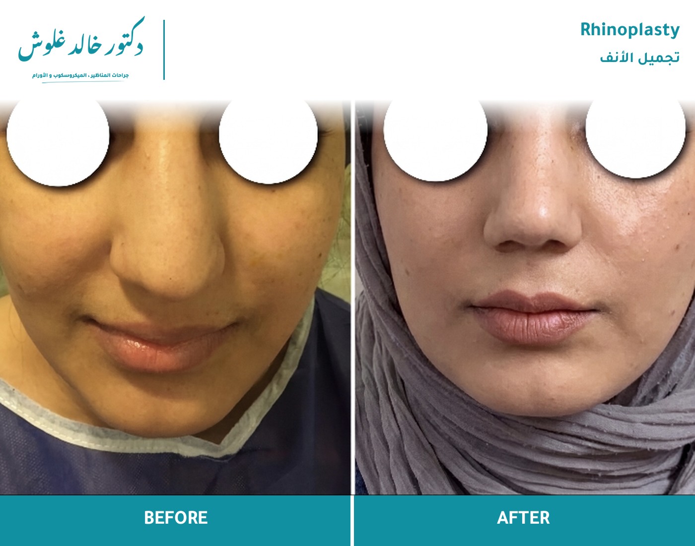 تناسق الجسر والطرف من الأمام